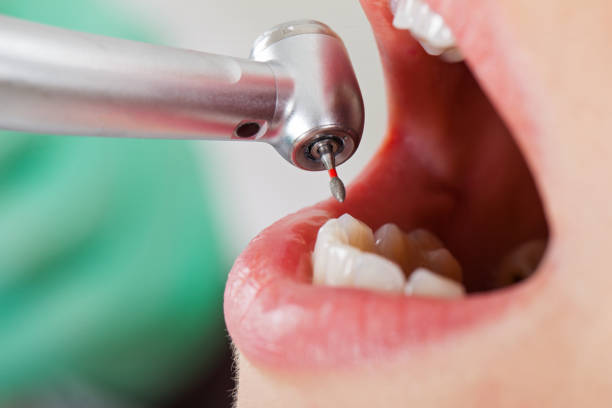 Best Emergency Dentist for Knocked-Out Tooth in Hastings, MI